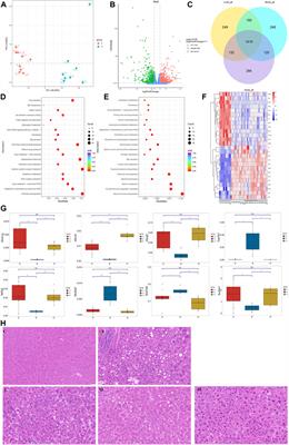 Chaihu Shugan prevents cholesterol gallstone formation by ameliorating the microbiota dysbiosis and metabolic disturbance in mice